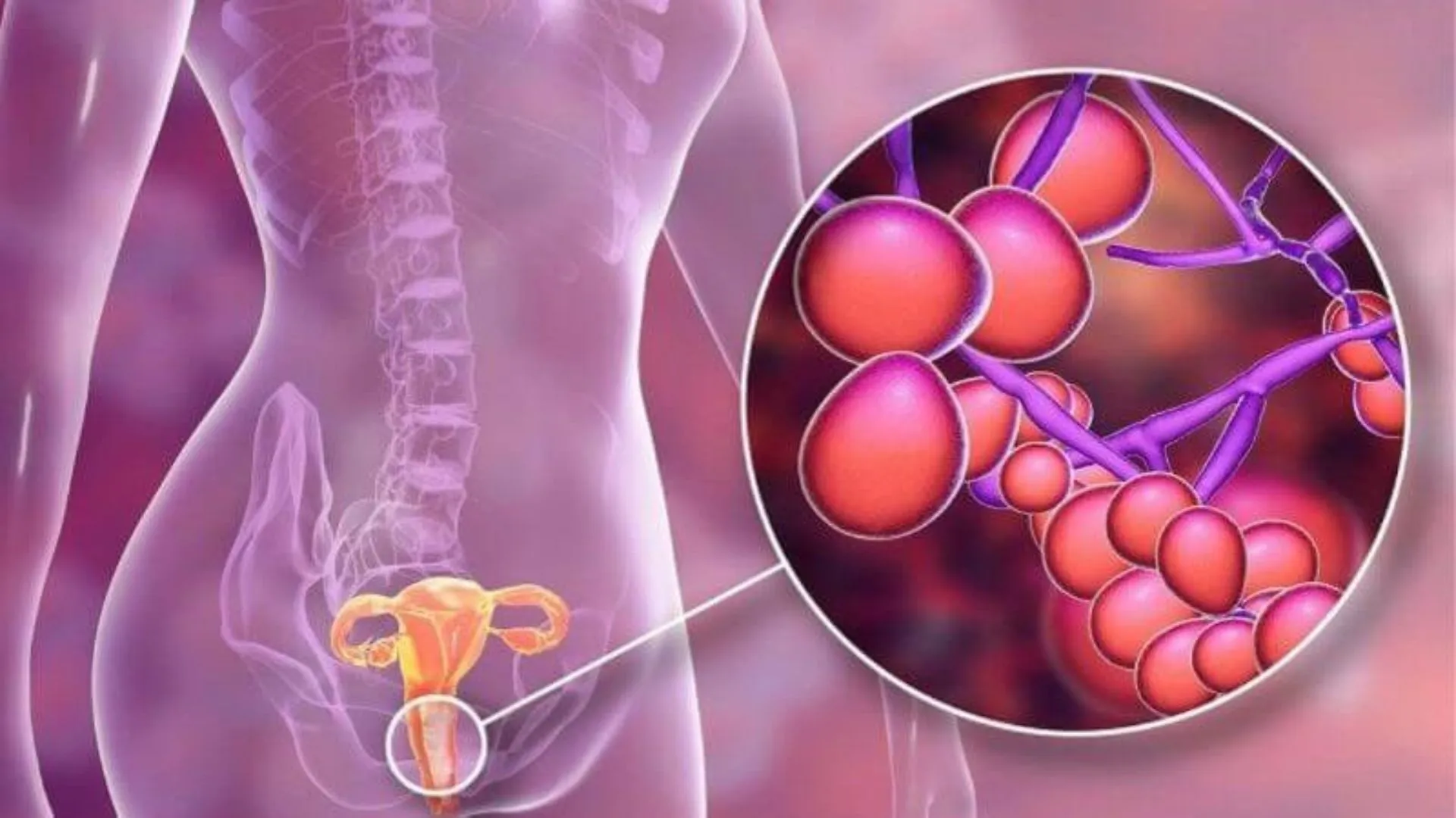 Điều trị niệu đạo có mủ bằng phương pháp nào? Khi nào cần gặp bác sĩ