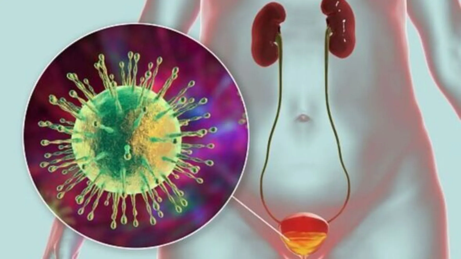 Điều trị viêm bàng quang cấp bằng các phương pháp nào hiệu quả?