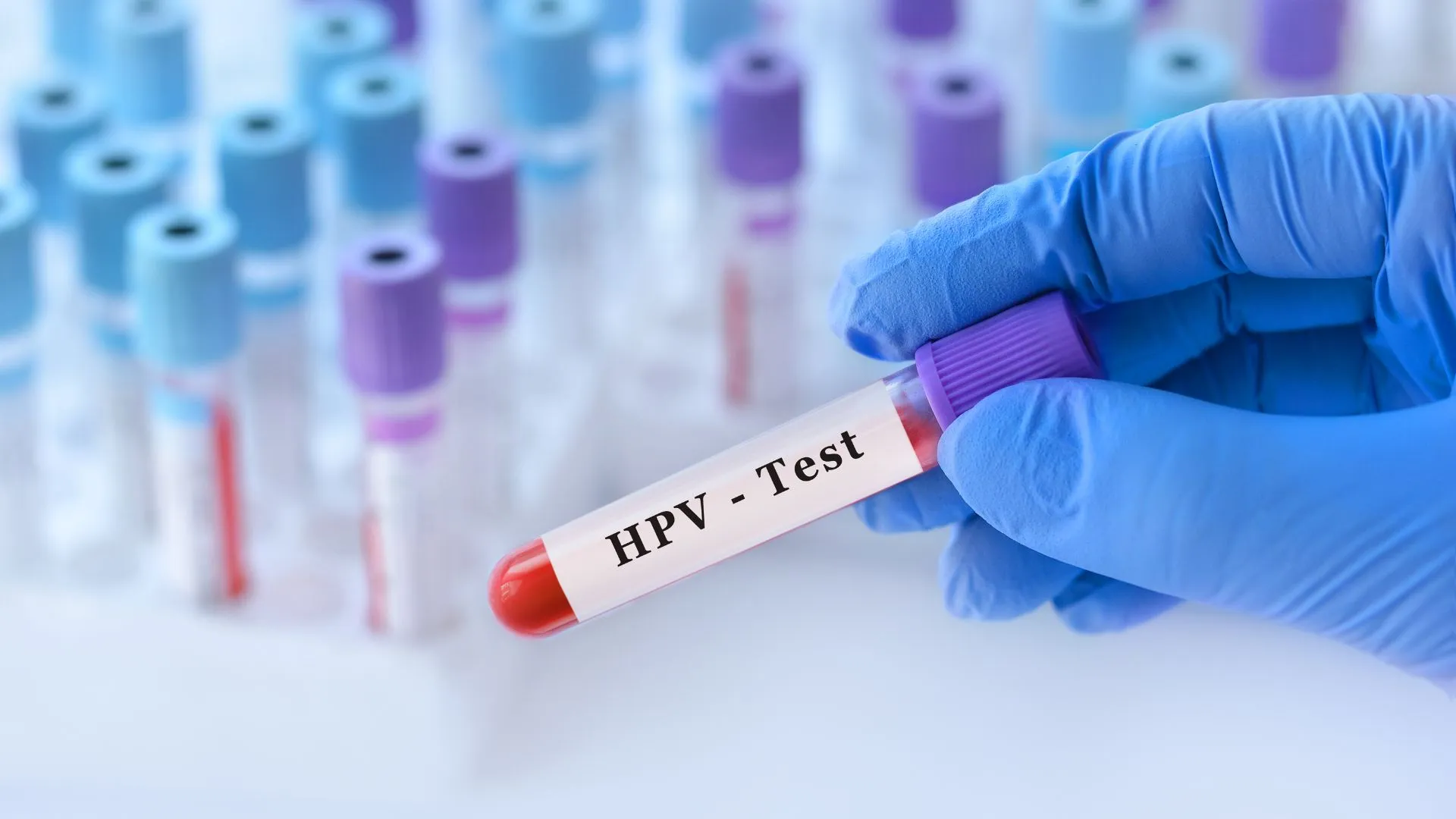 Sàng lọc ung thư cổ tử cung với bằng phương pháp hiệu quả hiện nay